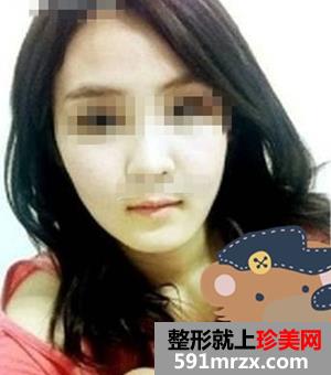八大处归来做磨腮削骨多少钱 他们都在问我