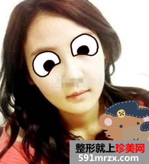 八大处归来做磨腮削骨多少钱 他们都在问我