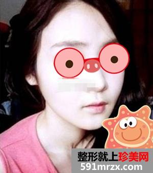 八大处归来做磨腮削骨多少钱 他们都在问我
