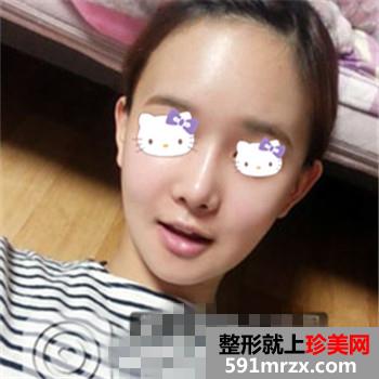 磨腮削骨手术