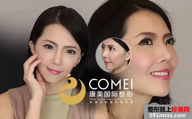 假体隆鼻,失败修复