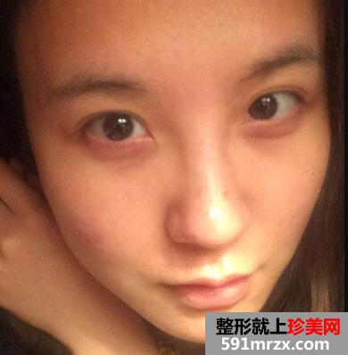 大S推荐的黑脸娃娃有效果吗？我的黑脸娃娃案例分享