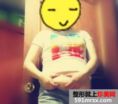 水动力吸脂瘦身减肥整形日记