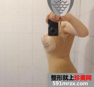 水动力吸脂瘦身减肥整形日记