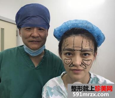 抽大腿脂肪做的全脸脂肪填充价格1.2w恢复3个月效果分享