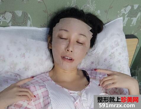 脸部脂肪填充多少钱？脸部脂肪填充消肿恢复过程真实案例