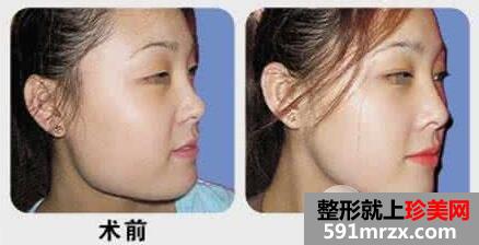 华美整形美容医院最新整形价格表曝光