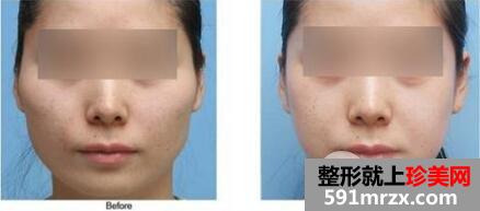 上海美联臣医院正规吗？整形价格表