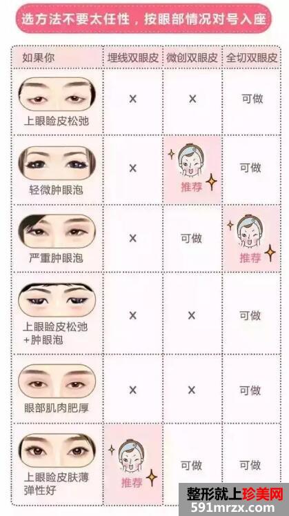 郑州华山整形双眼皮价格表