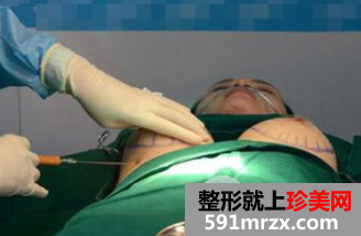 隆胸费用一般在多少?具体受到这些因素影响