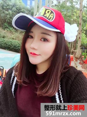 瘦脸吸脂术真实案例分享和前后照片对比