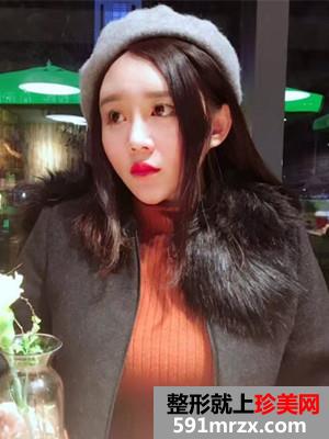 瘦脸吸脂术真实案例分享和前后照片对比