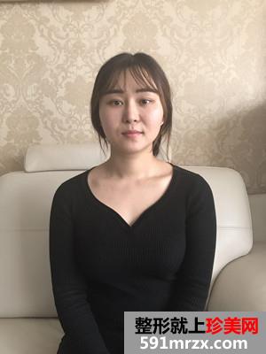 鼻综合修复+双下巴吸脂日记分享和前后对比照