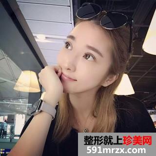 双眼皮修复+自体脂肪填充全脸手术前后对比照和恢复经验分享