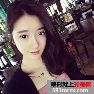 双眼皮修复+自体脂肪填充全脸手术前后对比照和恢复经验分享