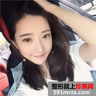 双眼皮修复+自体脂肪填充全脸手术前后对比照和恢复经验分享