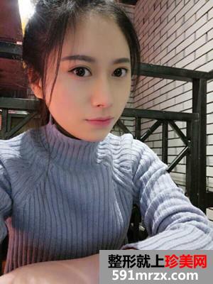 自体脂肪填充额头+太阳穴手术真实案例对比图和恢复过程