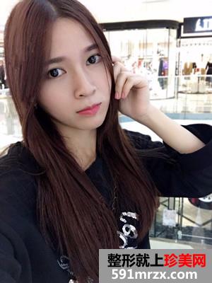保妥适瘦脸除咬肌日记分享还有前后恢复照片对比哦