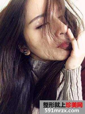 保妥适瘦脸除咬肌日记分享还有前后恢复照片对比哦