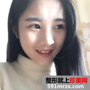 玻尿酸注射瘦脸除咬肌案例分享还有对比照片哦