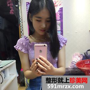 玻尿酸注射瘦脸除咬肌案例分享还有对比照片哦