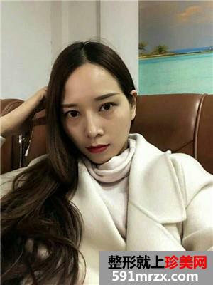 自体脂肪填充全脸效果图片和恢复经历