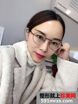 自体脂肪填充全脸效果图片和恢复经历