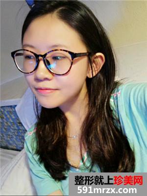 耳软骨鼻综合加眼综合手术恢复日记分享给大家