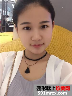 水光嫩肤补水前后对比照片和术后恢复