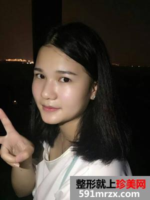 水光嫩肤补水前后对比照片和术后恢复