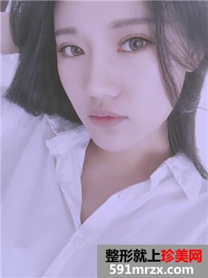 玻尿酸丰下巴术后恢复情况分享