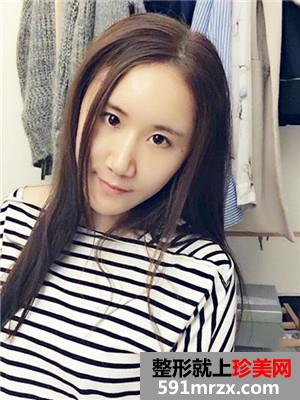 自体脂肪填充面部术后恢复记录还有前后对比照哦