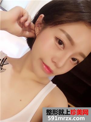 鼻翼缩小+硅胶假体隆鼻恢复过程记录和前后效果图对比