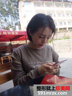 鼻翼缩小+硅胶假体隆鼻恢复过程记录和前后效果图对比