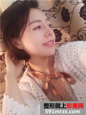 鼻翼缩小+硅胶假体隆鼻恢复过程记录和前后效果图对比
