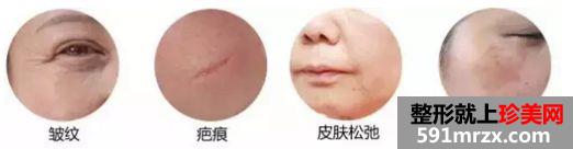 武汉医院做彩光嫩肤多少钱一次