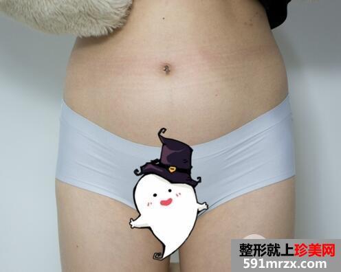 环形吸脂价格2