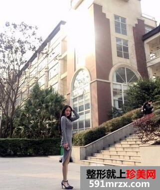 环形吸脂价格11