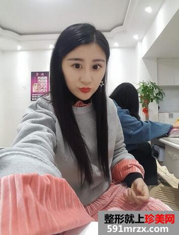 丰唇术的价格5