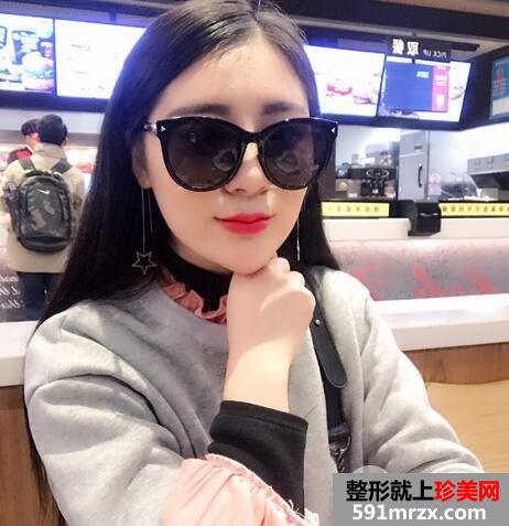 丰唇术的价格6