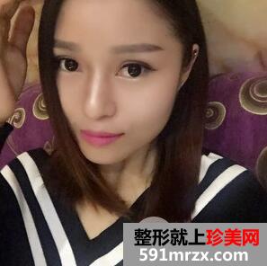 削骨瘦脸手术多少钱1