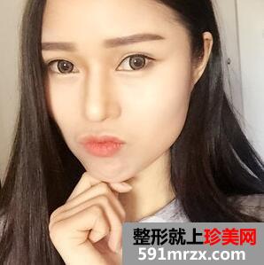 削骨瘦脸手术多少钱2