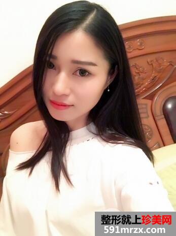 削骨瘦脸手术多少钱7