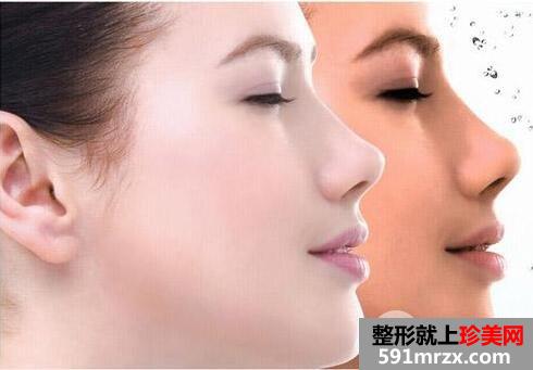 进口美白针价格2