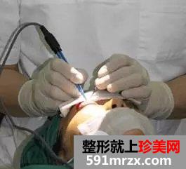 真人案例：小眯眯眼也可以完成大逆袭！