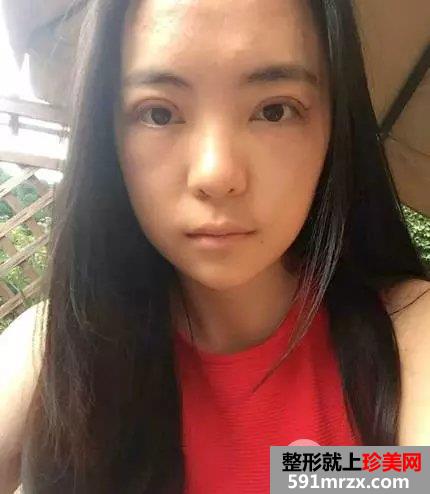 真人案例：小眯眯眼也可以完成大逆袭！