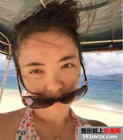 真人案例：小眯眯眼也可以完成大逆袭！