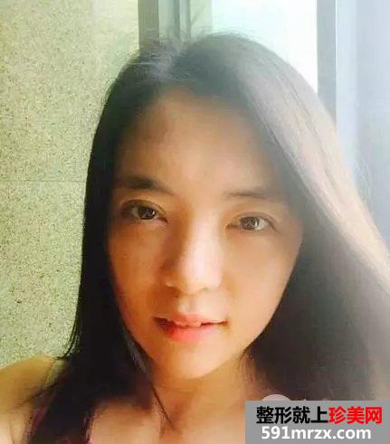 真人案例：小眯眯眼也可以完成大逆袭！