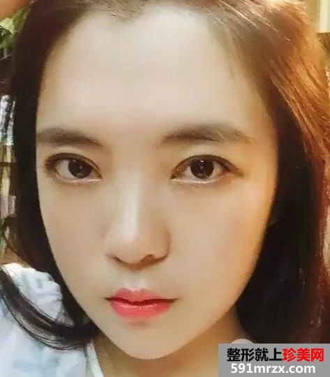 真人案例：小眯眯眼也可以完成大逆袭！