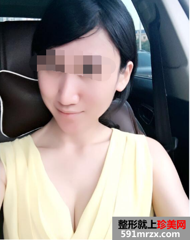 网友,分享,自体脂肪,移植,丰胸,手术,体会